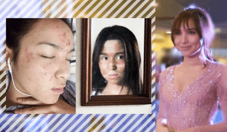 Kyline Alcantara talks self-love and embracing imperfections
