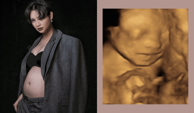 LOOK: Ryza Cenon shares sonogram of ‘happy’ baby boy