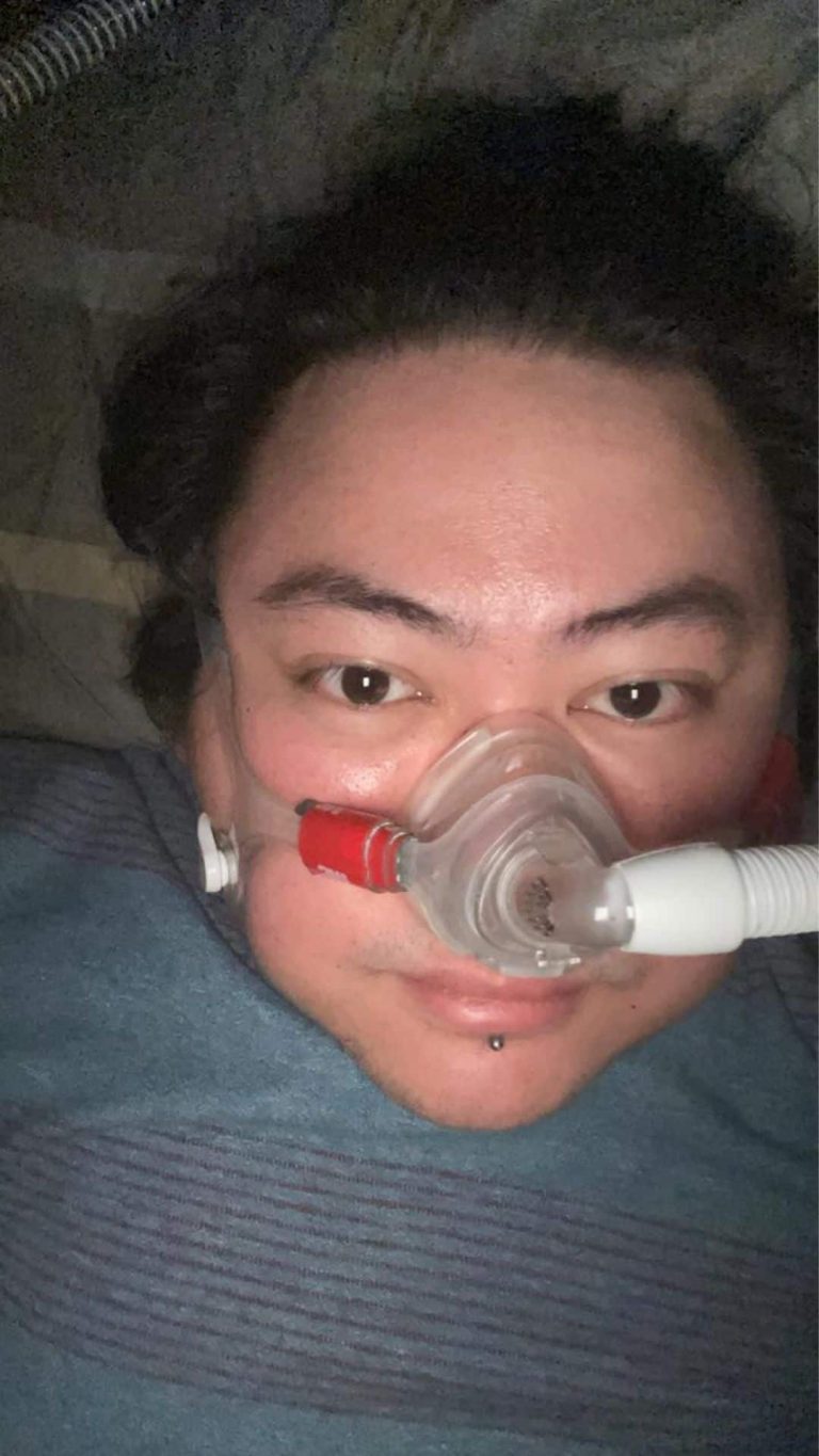 Director Jason Paul Laxamana opens up on how sleep apnea affected bout with COVID-19
