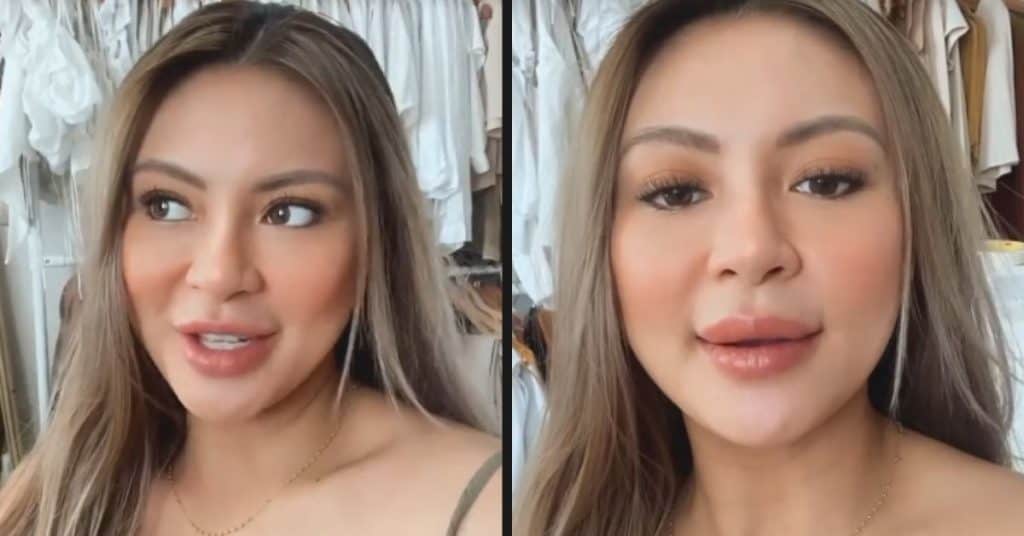 Sam Pinto denies having lip fillers