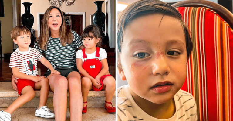 Korina Sanchez shows son Pepe’s injury after swimming accident
