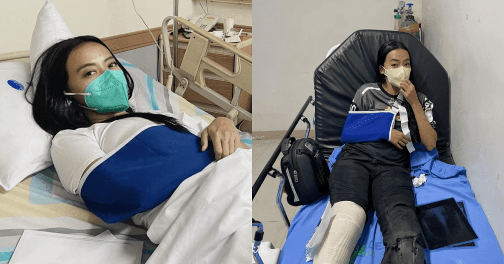 Mocha Uson undergoes surgery after motorcycle accident