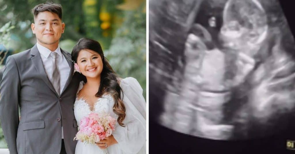 ‘Blessings after blessings’: Ynna Asistio gets married, expecting first child