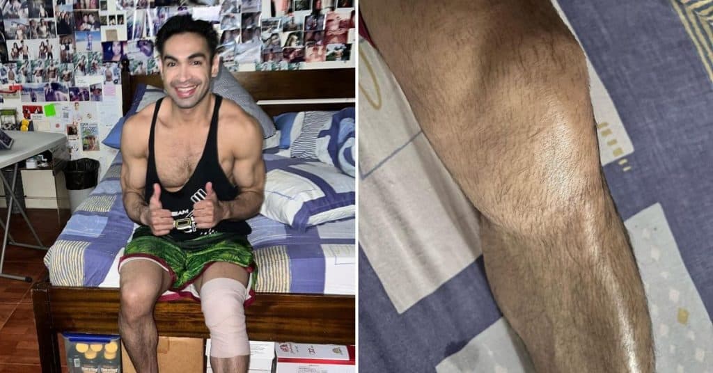 Carlo Agassi asks prayers for recovery after ‘freak accident’