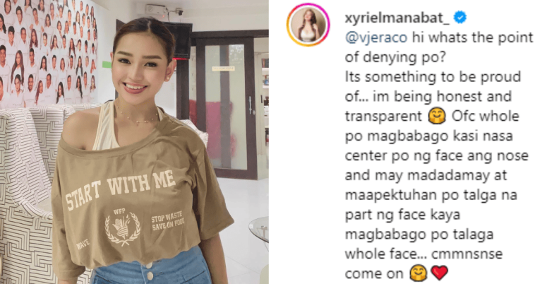 Xyriel Manabat shows off new look after nose job, claps back over full face surgery claims
