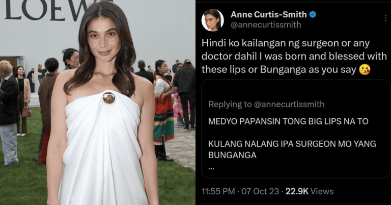 Anne Curtis shuts down basher calling her ‘big lips’ with grace and humor