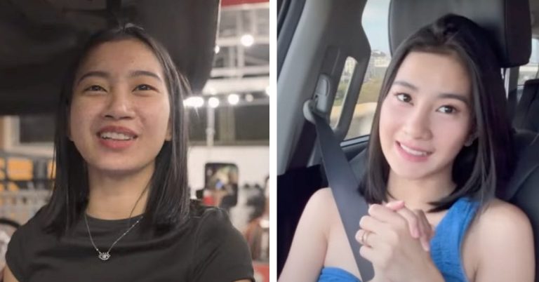 Team Payaman’s Vien Iligan reveals stunning transformation after cosmetic surgery