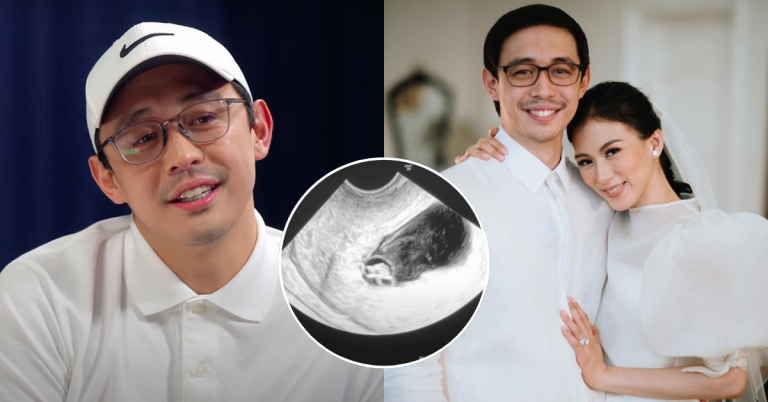 Mikee Morada reveals wife Alex Gonzaga’s third miscarriage