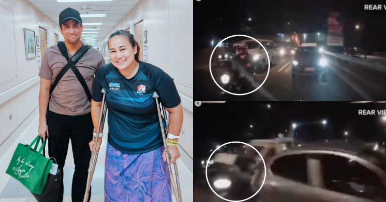 ‘Milagro’: Sam Milby shares sister’s close call from road accident