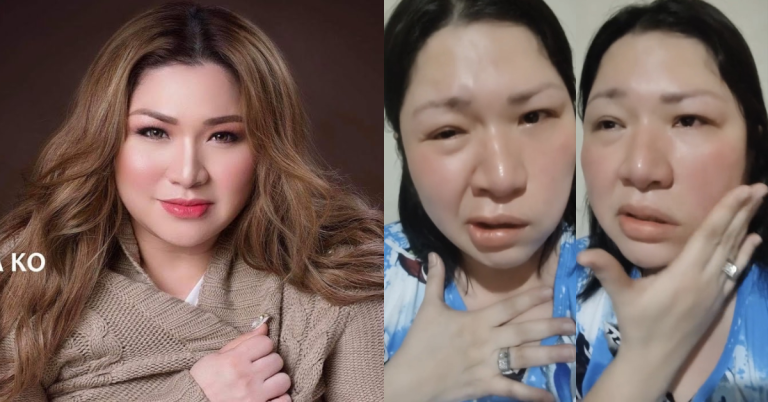 Singer Frenchie Dy suffers third Bell’s Palsy attack