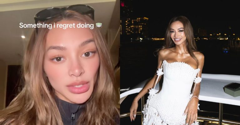 Kylie Verzosa regrets doing this facial enhancement