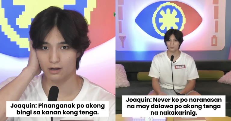 PBB housemate Joaquin Arce opens up about his disability